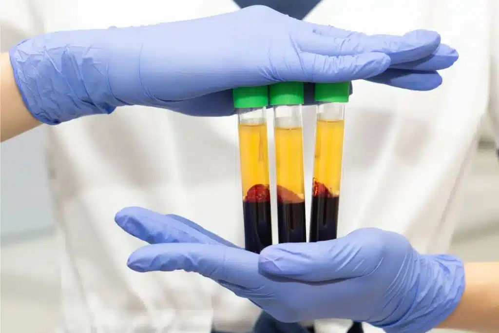 1761087368_Timeless-Youth-MD_Platelet-Rich-Plasma-PRP-Therapy-in-West-Des-Moines-IA-1