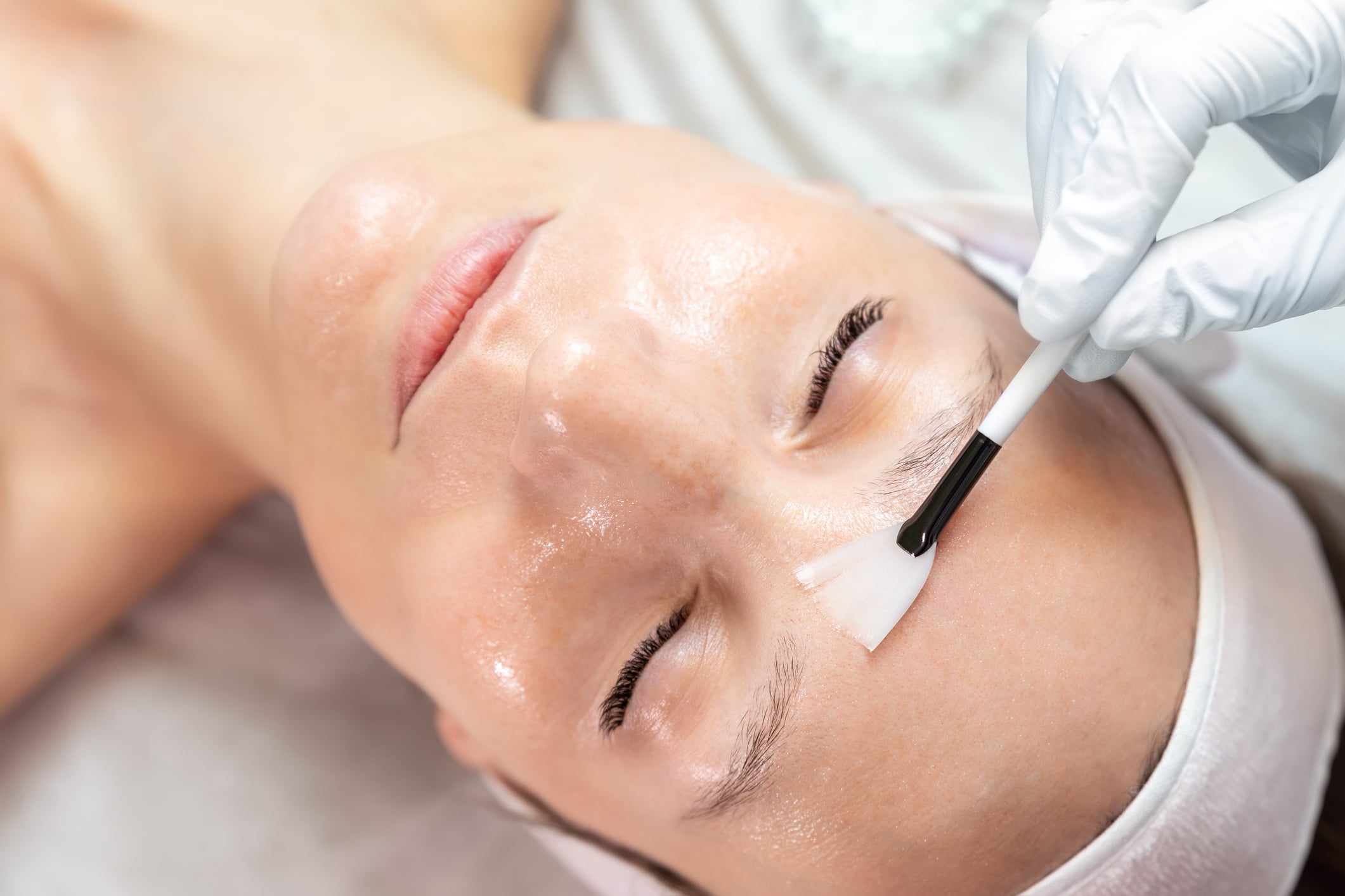 Close-up beautician doctor hand making anti-age procedure apply peeling acid young attractive female client at beauty clinic. Cosmetologist specialist doing skincare treatment. Health care therapy Chemical peel treatment applied to a patients forehead to improve skin texture and tone